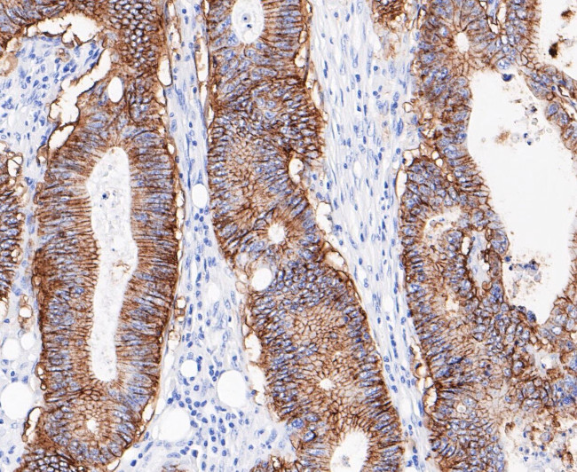 A33 Antibody in Immunohistochemistry (Paraffin) (IHC (P))