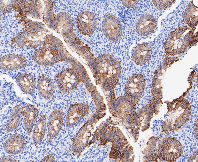 A33 Antibody in Immunohistochemistry (Paraffin) (IHC (P))