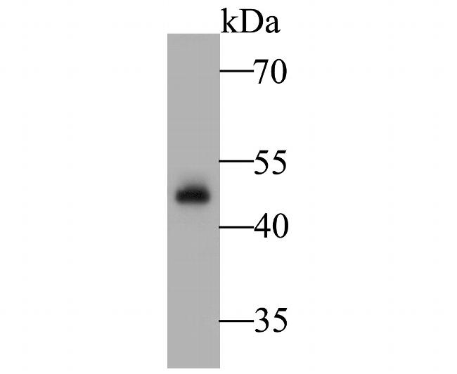 A33 Antibody in Western Blot (WB)