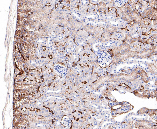 ABAT Antibody in Immunohistochemistry (Paraffin) (IHC (P))