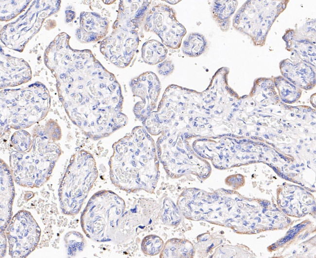 ABAT Antibody in Immunohistochemistry (Paraffin) (IHC (P))