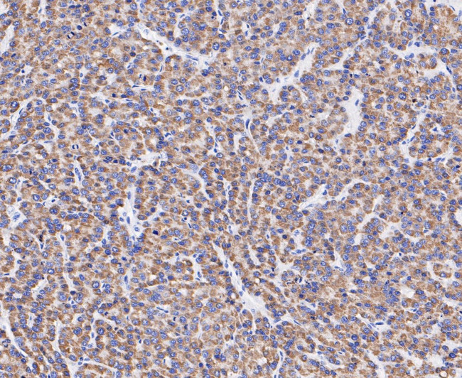 ABAT Antibody in Immunohistochemistry (Paraffin) (IHC (P))