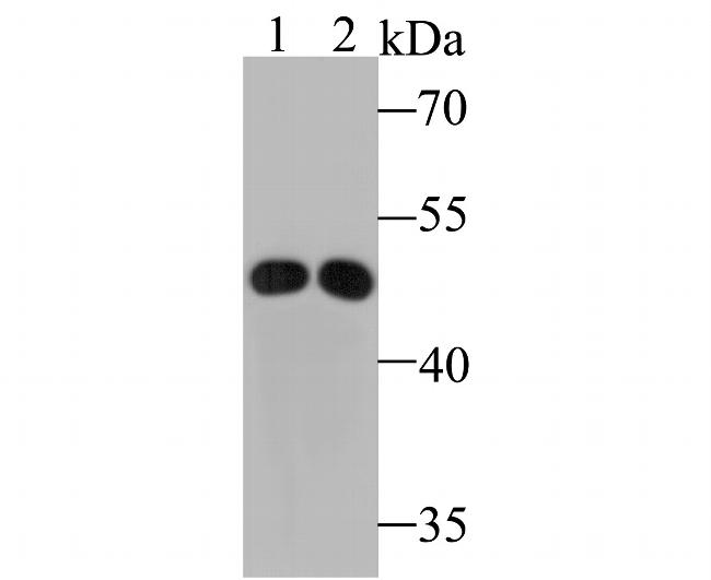 ABAT Antibody in Western Blot (WB)