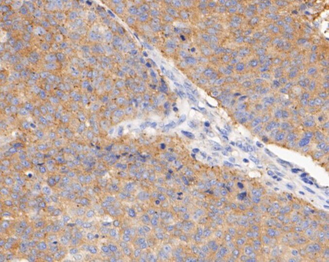 BCL2L12 Antibody in Immunohistochemistry (Paraffin) (IHC (P))