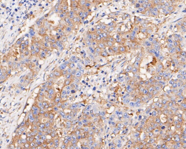 BCL2L12 Antibody in Immunohistochemistry (Paraffin) (IHC (P))