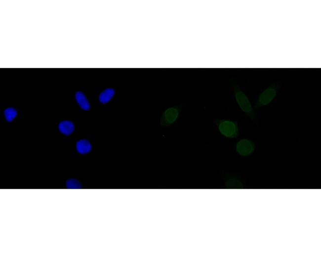 Lamin A/C Antibody in Immunocytochemistry (ICC/IF)