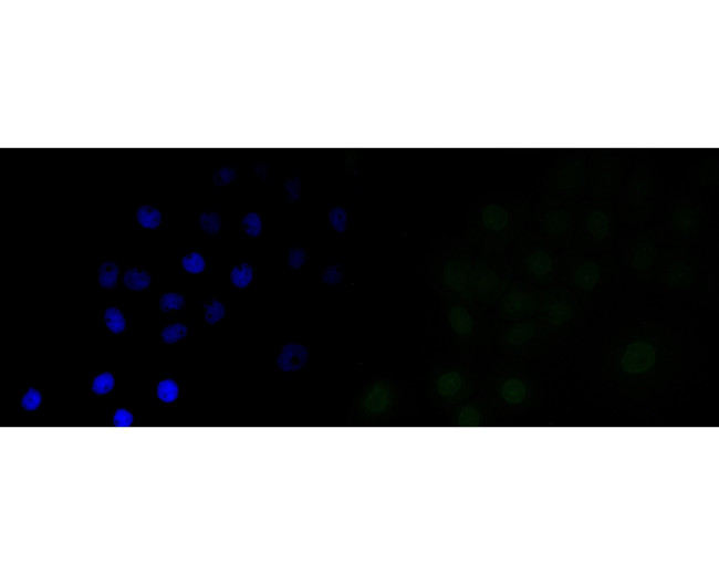 Lamin A/C Antibody in Immunocytochemistry (ICC/IF)