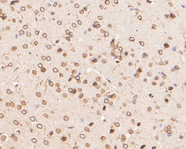 Lamin A/C Antibody in Immunohistochemistry (Paraffin) (IHC (P))