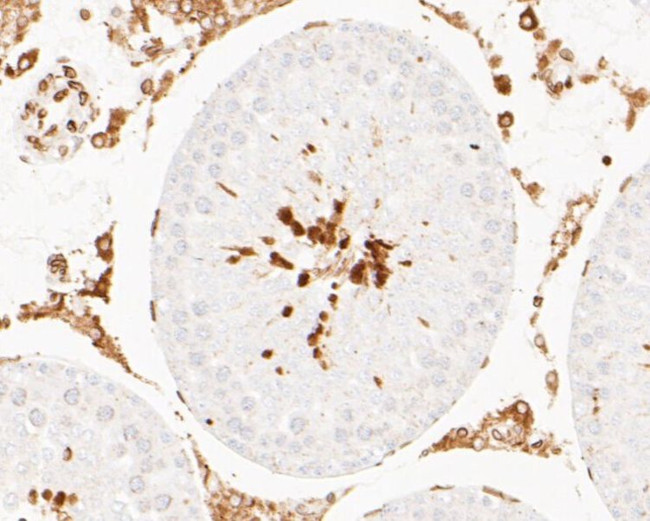 Lamin A/C Antibody in Immunohistochemistry (Paraffin) (IHC (P))