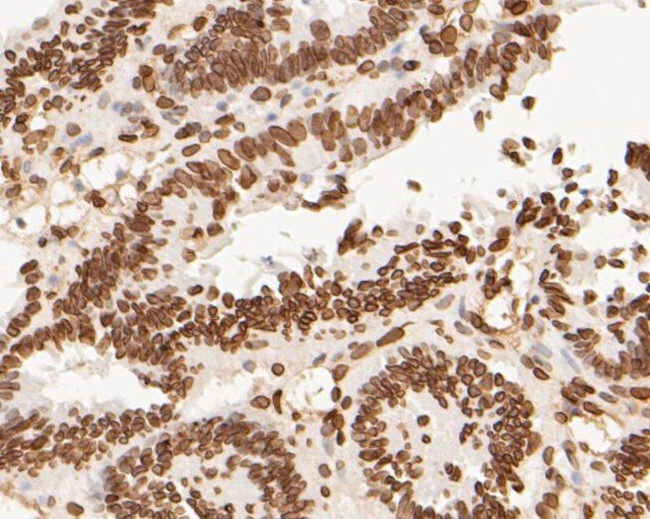 Lamin A/C Antibody in Immunohistochemistry (Paraffin) (IHC (P))