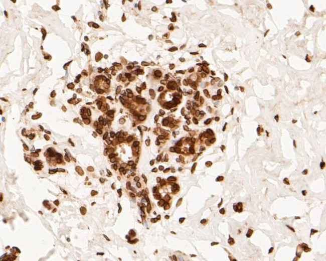 Lamin A/C Antibody in Immunohistochemistry (Paraffin) (IHC (P))