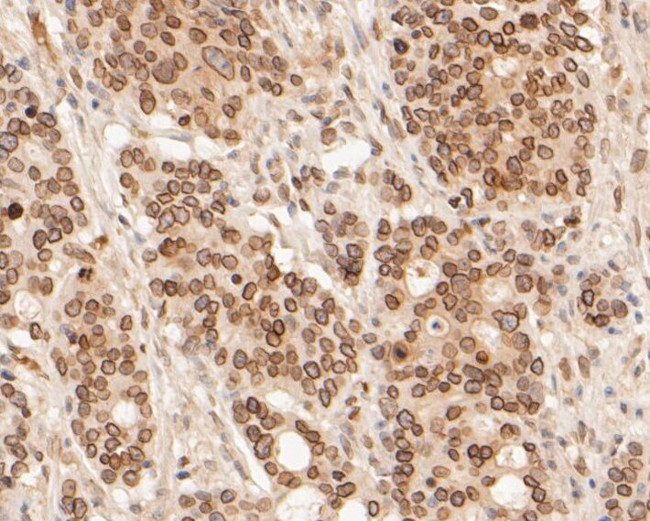 Lamin A/C Antibody in Immunohistochemistry (Paraffin) (IHC (P))