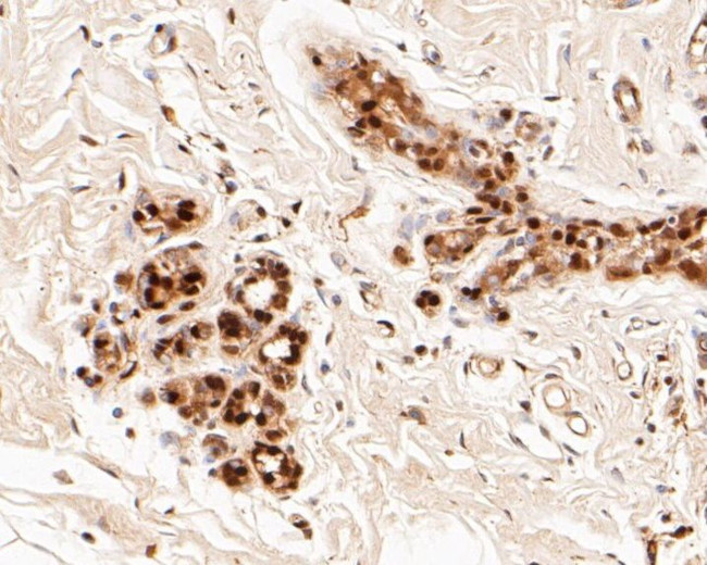 LTA4H Antibody in Immunohistochemistry (Paraffin) (IHC (P))