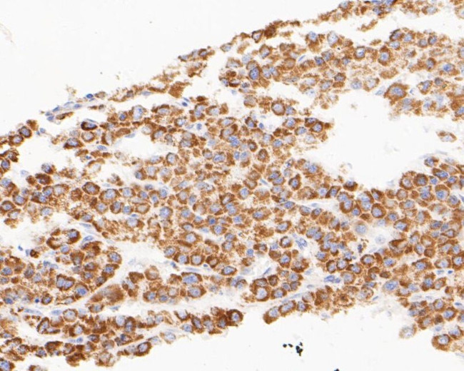 TIMM50 Antibody in Immunohistochemistry (Paraffin) (IHC (P))