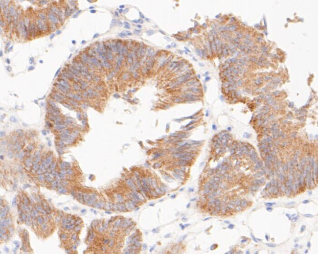 TIMM50 Antibody in Immunohistochemistry (Paraffin) (IHC (P))