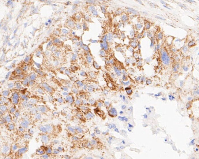 TIMM50 Antibody in Immunohistochemistry (Paraffin) (IHC (P))