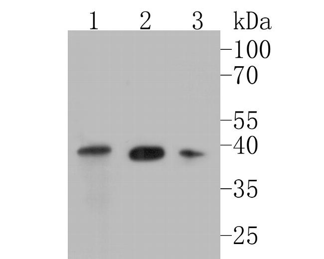 TIMM50 Antibody in Western Blot (WB)