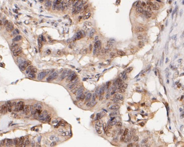 WAPL Antibody in Immunohistochemistry (Paraffin) (IHC (P))