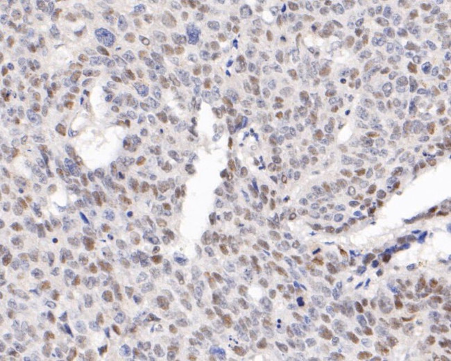 WAPL Antibody in Immunohistochemistry (Paraffin) (IHC (P))