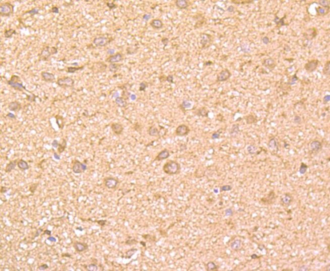 GRB2 Antibody in Immunohistochemistry (Paraffin) (IHC (P))