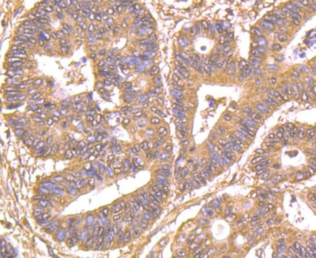 GRB2 Antibody in Immunohistochemistry (Paraffin) (IHC (P))