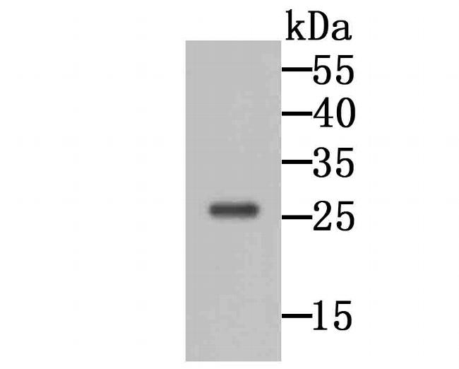 GRB2 Antibody in Western Blot (WB)