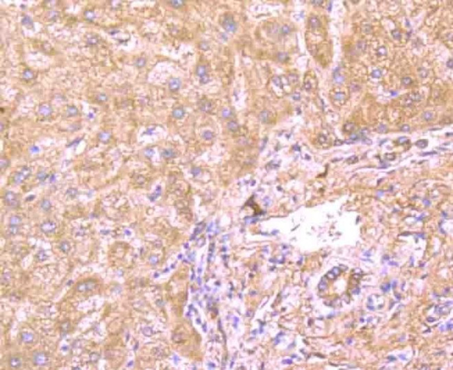 GP130 Antibody in Immunohistochemistry (Paraffin) (IHC (P))