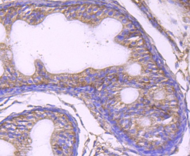 UAP1 Antibody in Immunohistochemistry (Paraffin) (IHC (P))