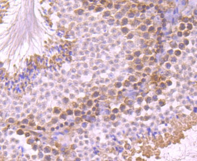 UAP1 Antibody in Immunohistochemistry (Paraffin) (IHC (P))