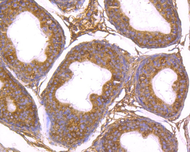 ADAM7 Antibody in Immunohistochemistry (Paraffin) (IHC (P))