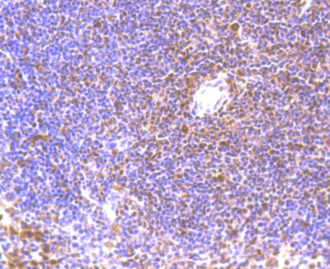 BMI-1 Antibody in Immunohistochemistry (Paraffin) (IHC (P))