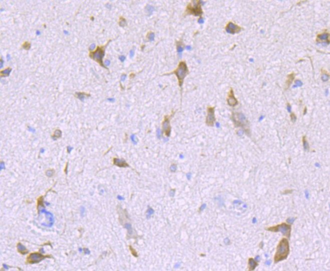 LNP Antibody in Immunohistochemistry (Paraffin) (IHC (P))