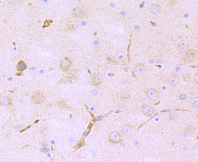 LNP Antibody in Immunohistochemistry (Paraffin) (IHC (P))