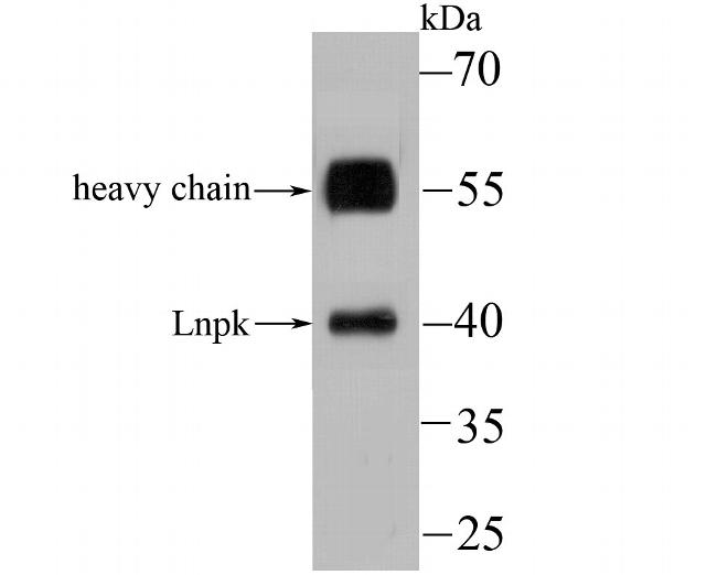 LNP Antibody in Western Blot (WB)