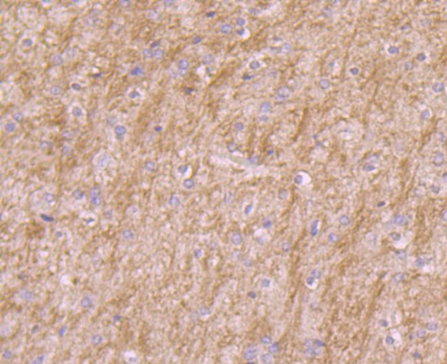 PI3K p85 alpha Antibody in Immunohistochemistry (Paraffin) (IHC (P))