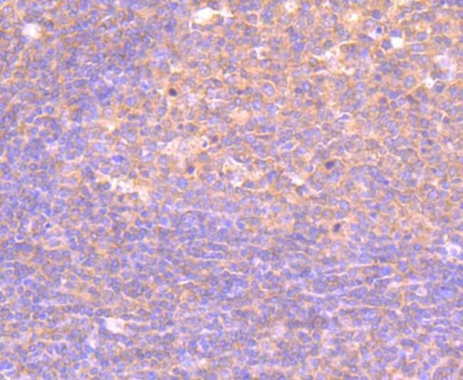 PI3K p85 alpha Antibody in Immunohistochemistry (Paraffin) (IHC (P))