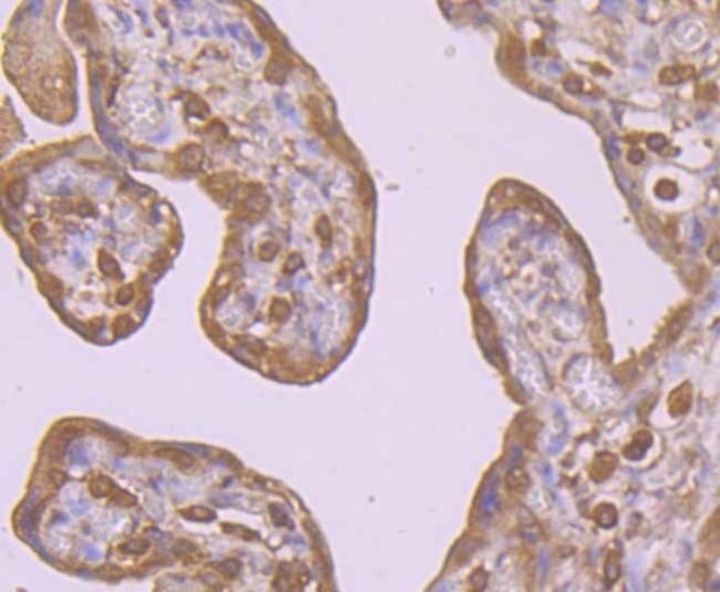 PI3K p85 alpha Antibody in Immunohistochemistry (Paraffin) (IHC (P))