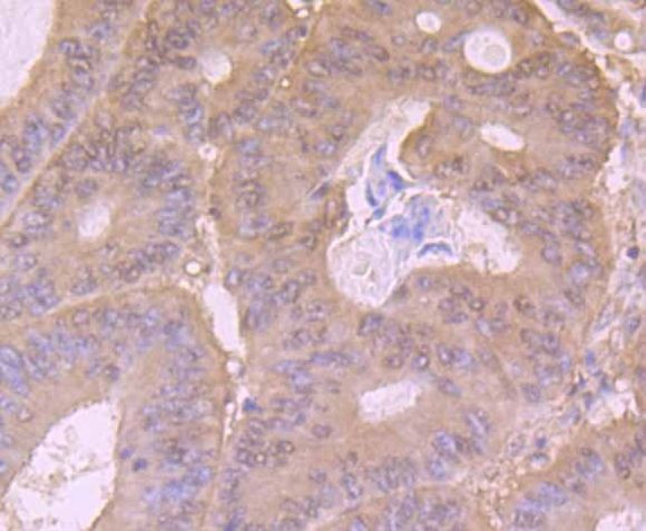 PI3K p85 alpha Antibody in Immunohistochemistry (Paraffin) (IHC (P))