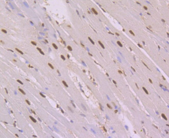 NFIB Antibody in Immunohistochemistry (Paraffin) (IHC (P))