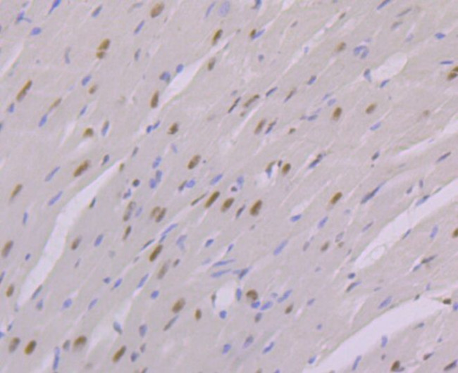 NFIB Antibody in Immunohistochemistry (Paraffin) (IHC (P))