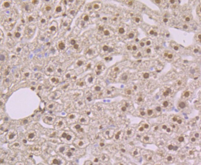 NFIB Antibody in Immunohistochemistry (Paraffin) (IHC (P))