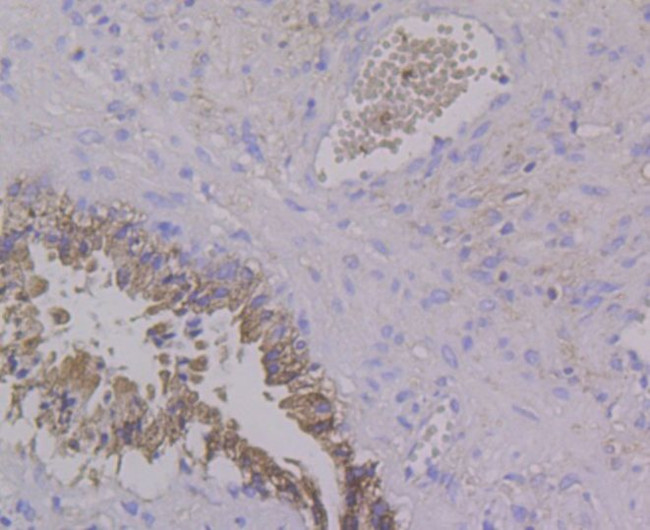 ALDH4A1 Antibody in Immunohistochemistry (Paraffin) (IHC (P))