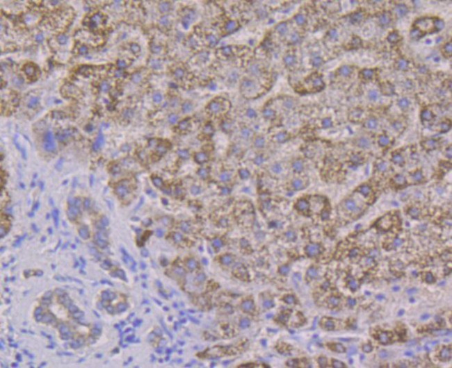 ALDH4A1 Antibody in Immunohistochemistry (Paraffin) (IHC (P))