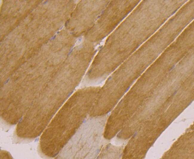 UGP2 Antibody in Immunohistochemistry (Paraffin) (IHC (P))