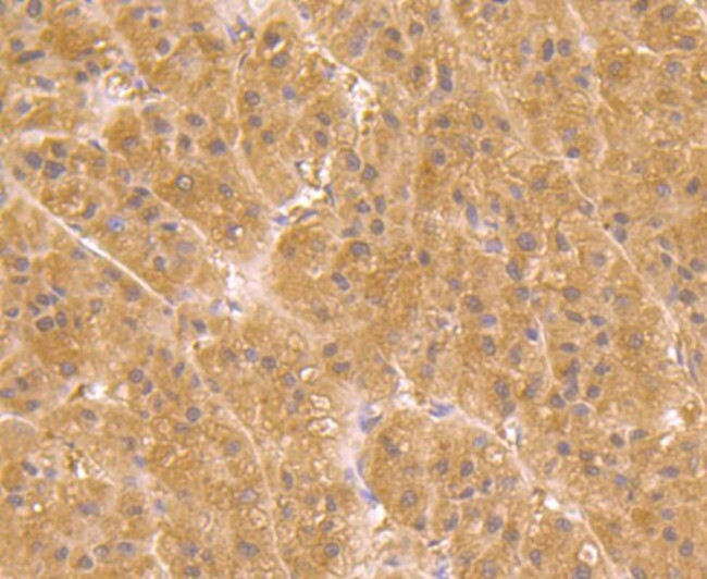 UGP2 Antibody in Immunohistochemistry (Paraffin) (IHC (P))