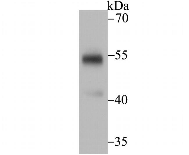 UGP2 Antibody in Western Blot (WB)