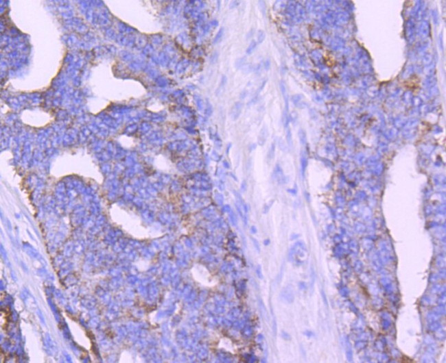 AMACR Antibody in Immunohistochemistry (Paraffin) (IHC (P))