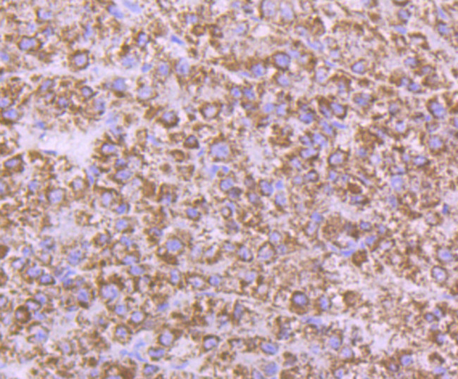 AMACR Antibody in Immunohistochemistry (Paraffin) (IHC (P))