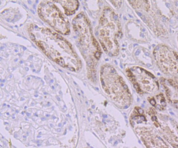 AMACR Antibody in Immunohistochemistry (Paraffin) (IHC (P))