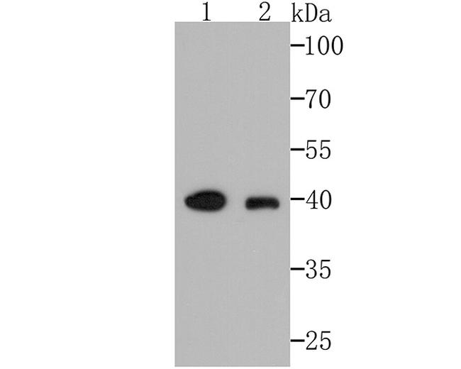 AMACR Antibody in Western Blot (WB)